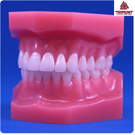 Model For Malocclusion, Class III